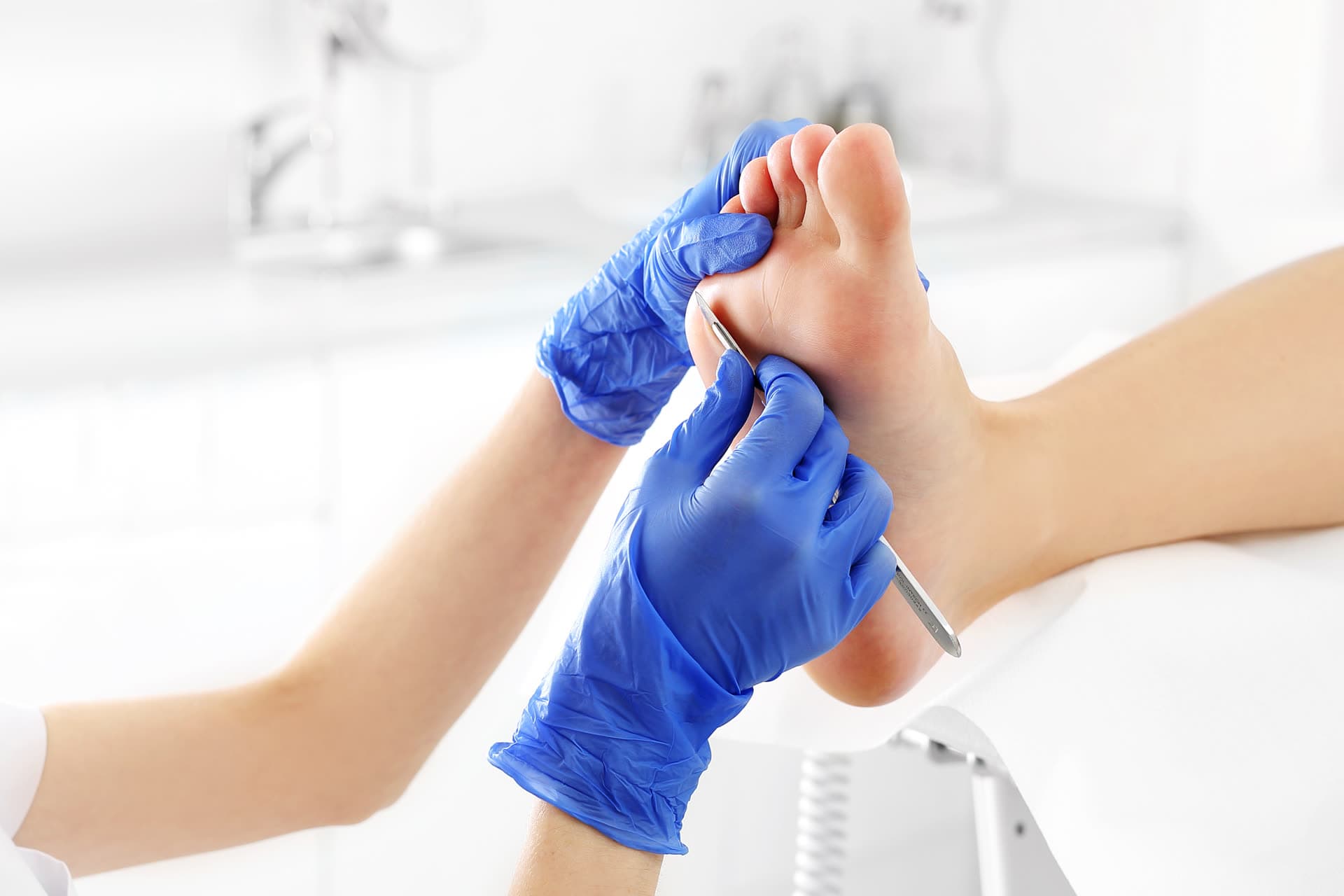 Traitement — étape des soins de pédicurie au cabinet Renevey & Dourgian à Dijon